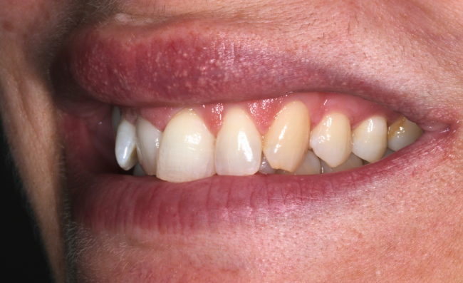 Before - Dr Saf Johar