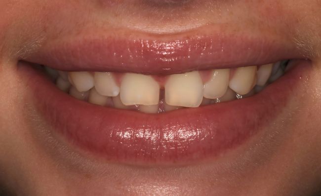 Before - Dr Saf Johar